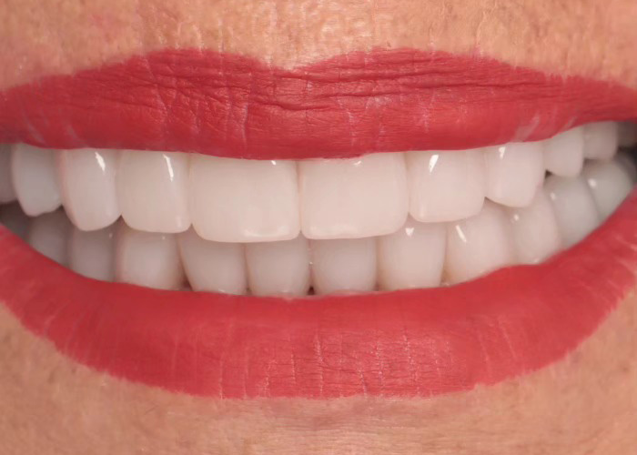 The Impact of a Well-Crafted Smile