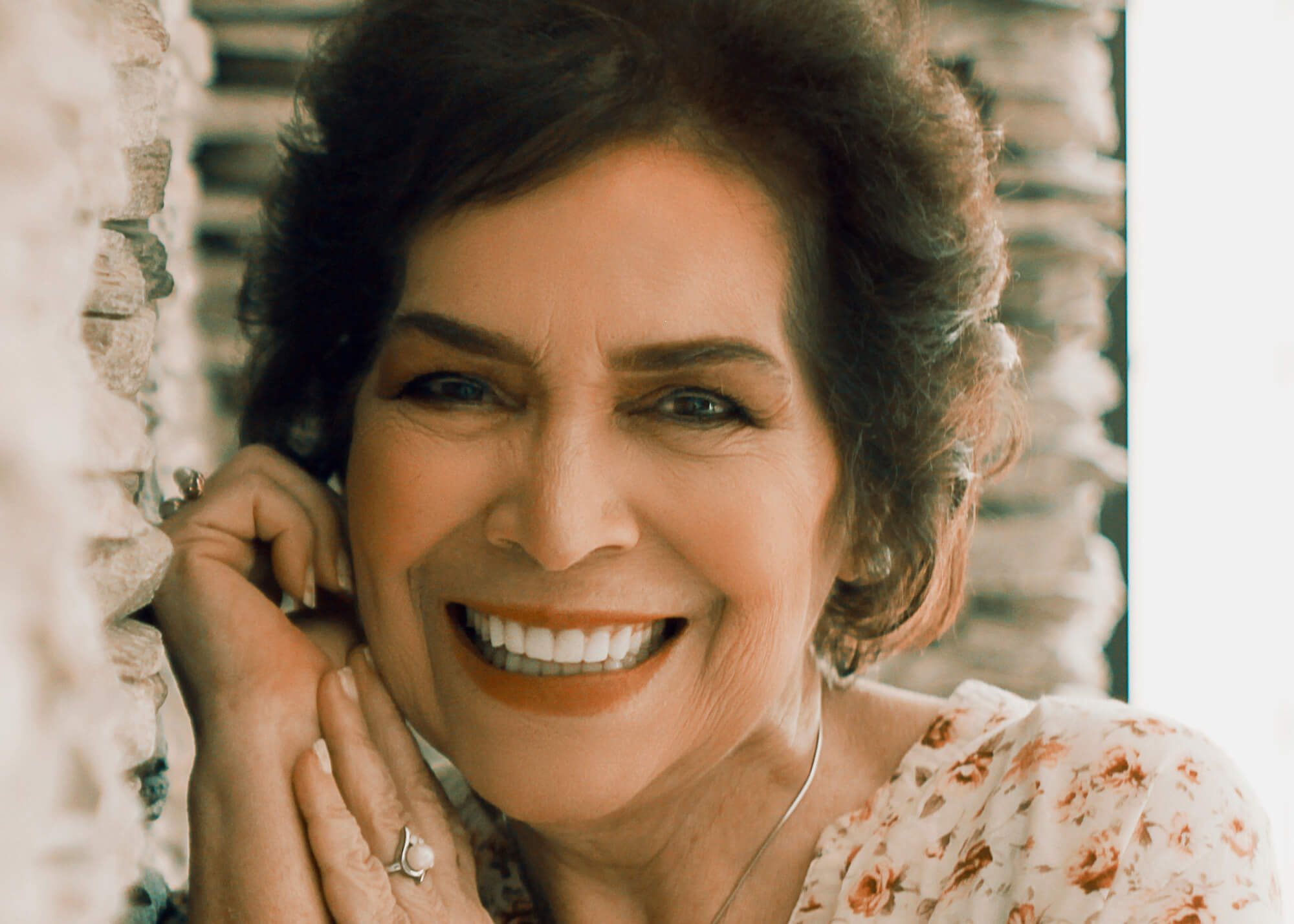 Can I Get a Full Mouth of Dental Implants?