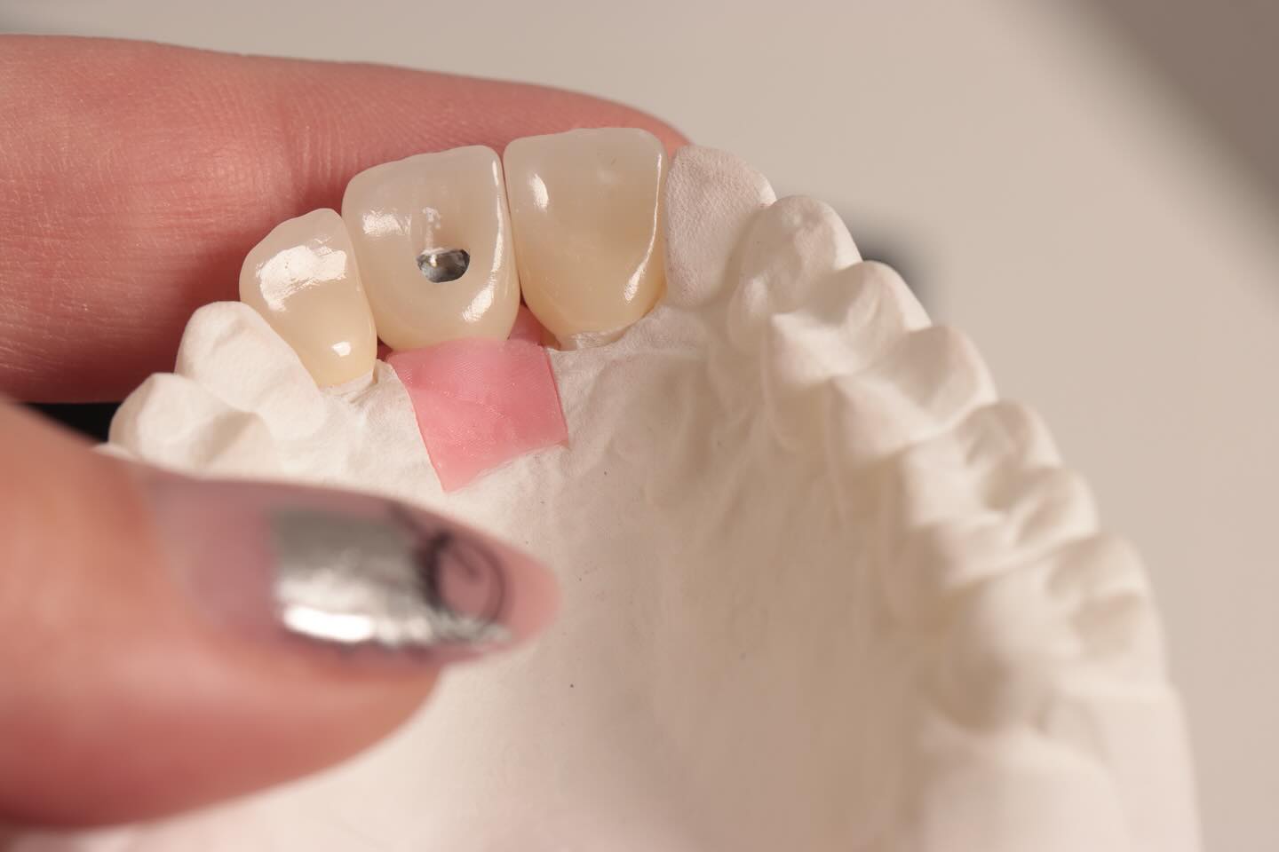 Image Description Here