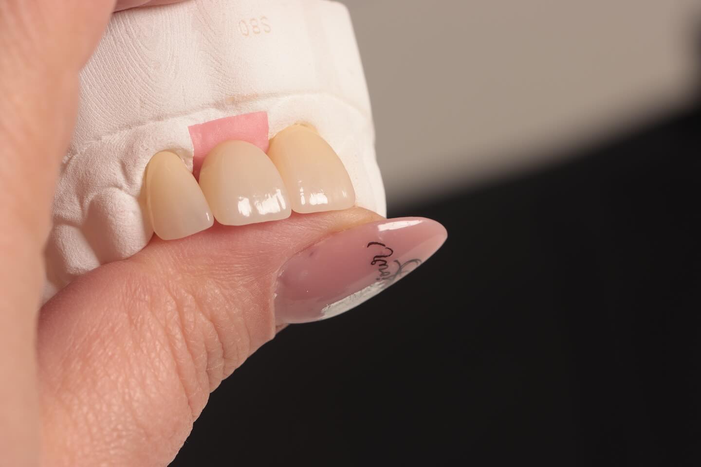 A Masterpiece in Dental Restoration