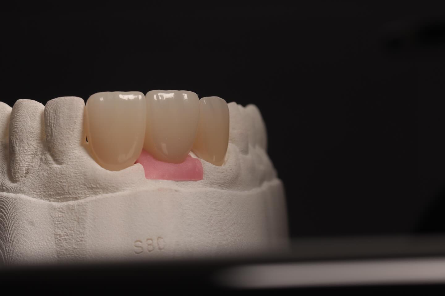 Image Description Here