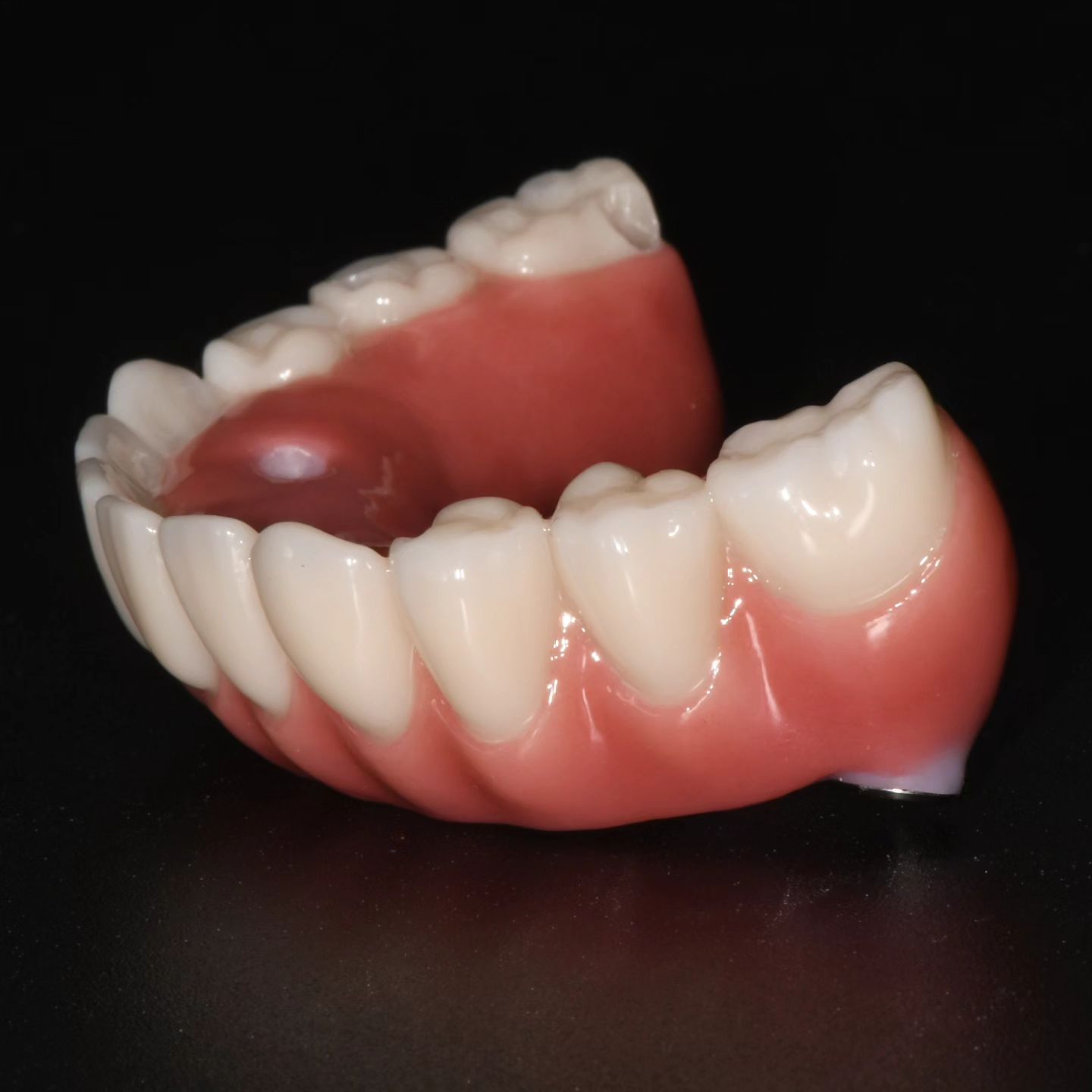The Amazing Zirconia Hybrid Prosthesis