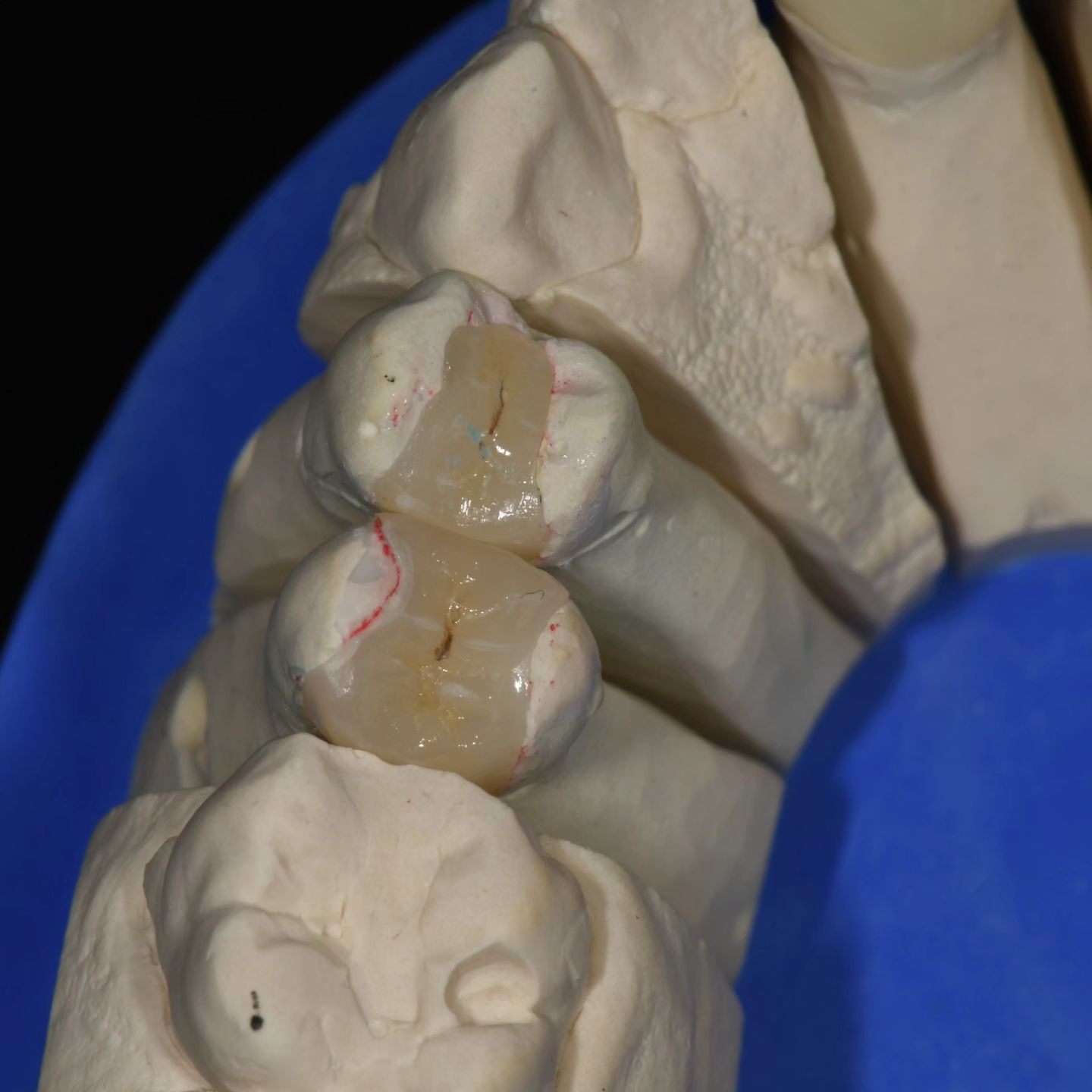 Image Description Here