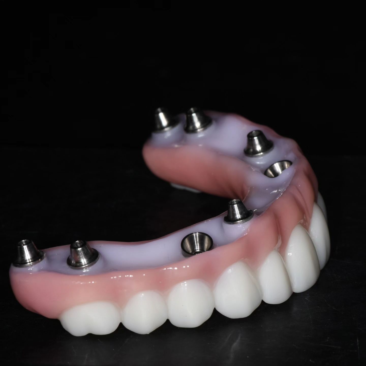 Why choose non-removable dental implants?